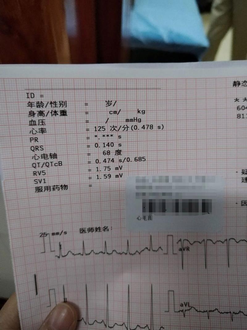 教资体检心率过快能过吗-图1